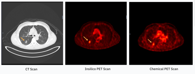 RADiCAIT использует ИИ для доступной диагностической визуализации
